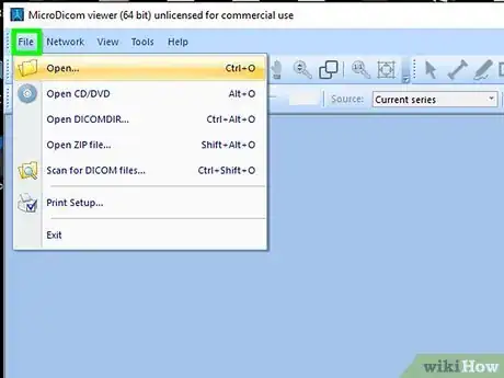 Image titled Open a DICOM File on PC or Mac Step 16