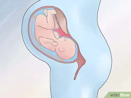 Image titled Increase Amniotic Fluid Step 13