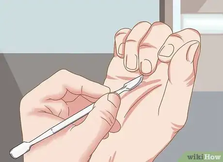 Image titled Use Nail Clippers Step 12