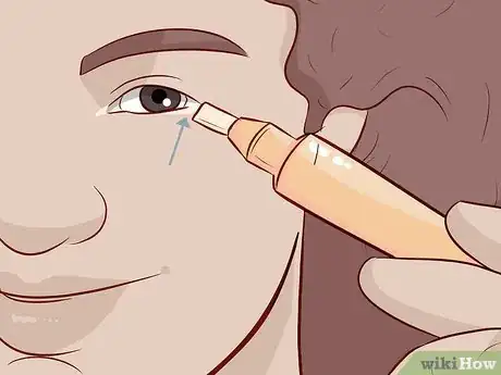 Image titled Cover Dark Circles Without Foundation Step 10