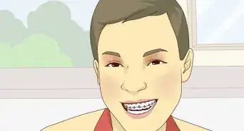 Look Great With Braces