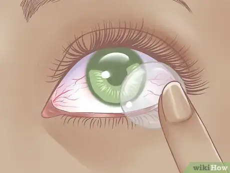 Image titled Care for Contact Lenses Step 12