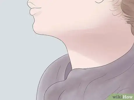 Image titled Get Rid of a Hickey Fast Step 11