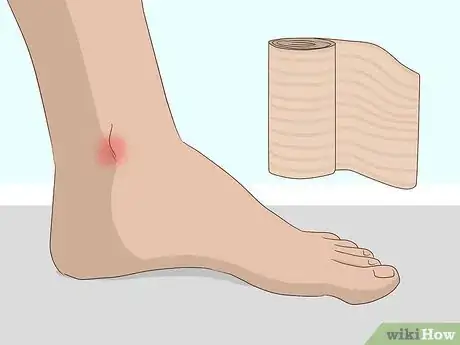 Image titled Wrap an Ankle with an ACE Bandage Step 9