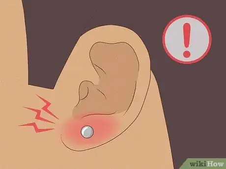 Image titled Reduce Pain Caused by a New Piercing Step 12