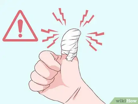 Image titled Bandage Fingers or Toes Step 19