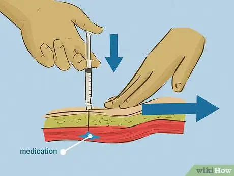 Image titled Give an Intramuscular Injection Step 17