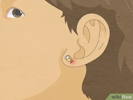 Image titled When to Pierce Baby Ears Step 2