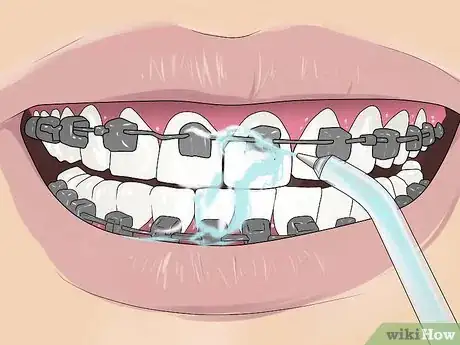 Image titled Floss With Braces Step 12