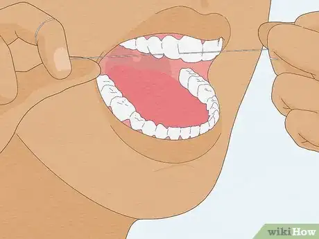 Image titled Fix a Loose Tooth Step 3