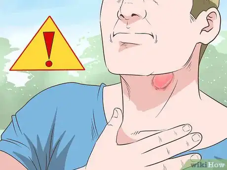 Image titled Get Rid of a Sore Throat Quickly Step 19