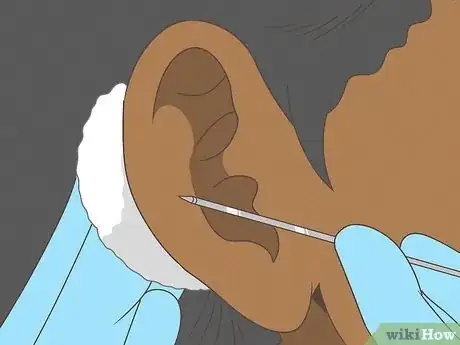 Image titled Pierce Your Own Cartilage Step 9