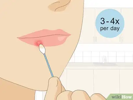 Image titled Treat Cold Sores with Essential Oils Step 8