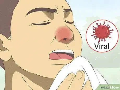 Image titled Differentiate Bacterial Tonsillitis and Viral Tonsillitis Step 1