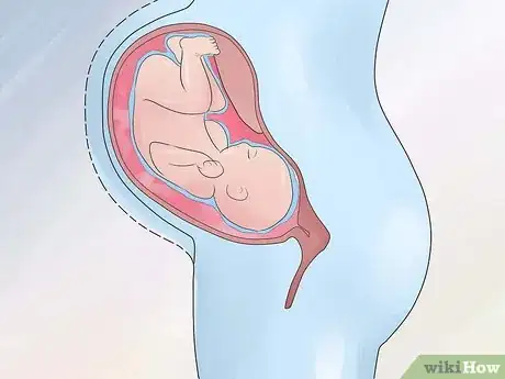 Image titled Increase Amniotic Fluid Step 14