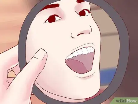 Image titled Tell if You Have Mouth Cancer Step 11