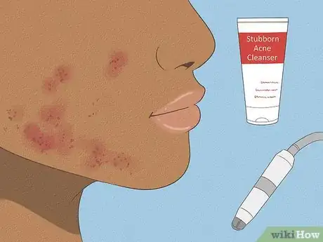 Image titled Get Great Looking Skin Step 13