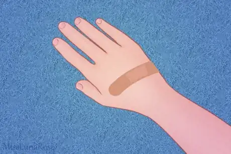 Image titled Child's Hand with Bandage.png