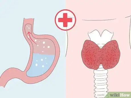 Image titled Dissolve Nodules Naturally Step 14