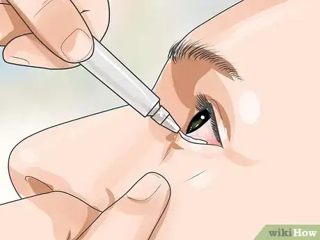 Image titled Recover from Eye Surgery Step 15