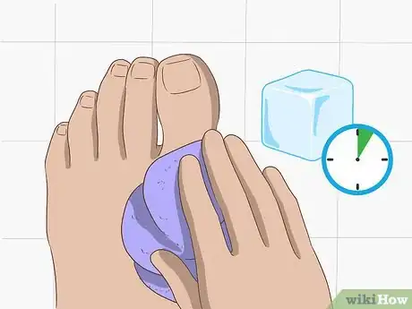 Image titled Stop a Bunion from Growing Step 10