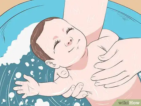 Image titled Identify and Treat Different Types of Diaper Rash Step 13