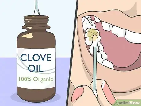 Image titled Use Clove Oil for Tooth Pain Step 2