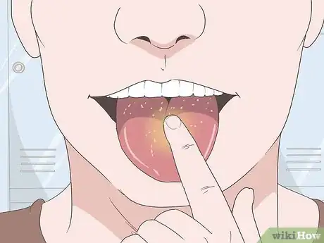 Image titled Heal Your Tongue After Eating Sour Candy Step 1