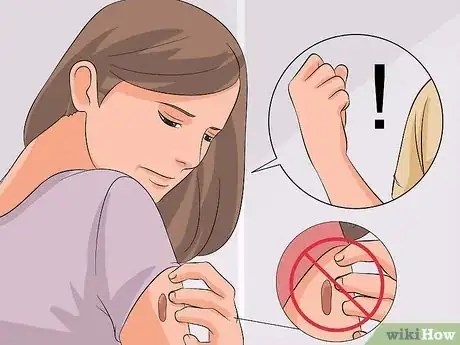 Image titled Stop Picking Your Scabs Step 11