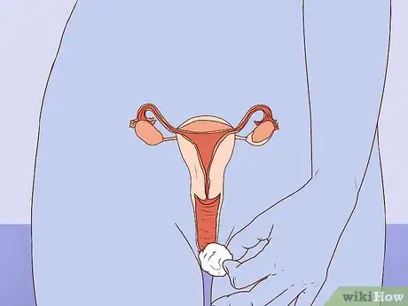 Image titled Balance Vaginal pH Step 8