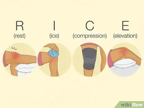 Image titled Heal a Meniscus Tear Step 2