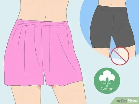 Image titled Get Rid of a Rash Between Your Legs Step 1