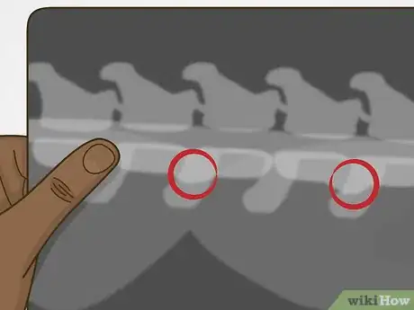 Image titled Diagnose and Treat Spondylosis Deformans in Cats Step 6