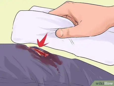 Image titled Treat Severe Bleeding During First Aid Step 10