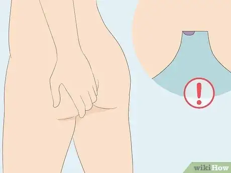 Image titled Get Rid of Hemorrhoids Fast Step 13