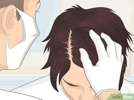 Image titled Bumps on Scalp Step 15