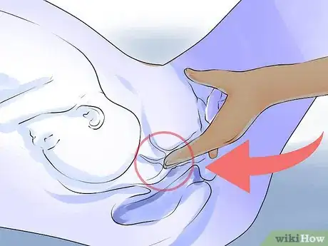 Image titled Check a Cervix for Dilation Step 6