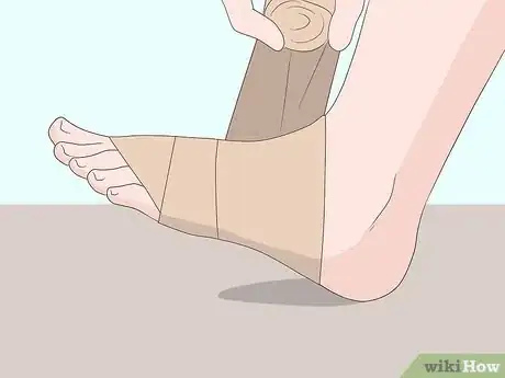 Image titled Wrap an Ankle with an ACE Bandage Step 4