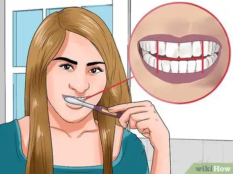 Image titled Clean Teeth With Braces Step 3