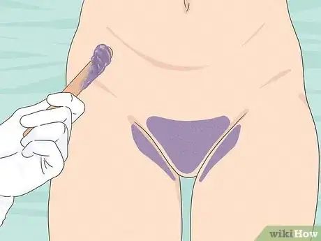 Image titled Avoid Pubic Razor Bumps Step 11