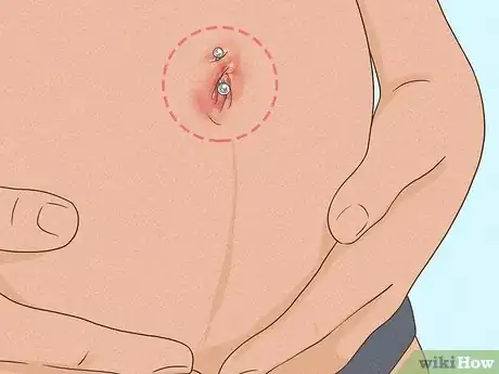 Image titled Manage Belly Button Rings During Pregnancy Step 6