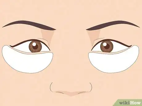 Image titled Get Rid of Tired Eyes Step 11