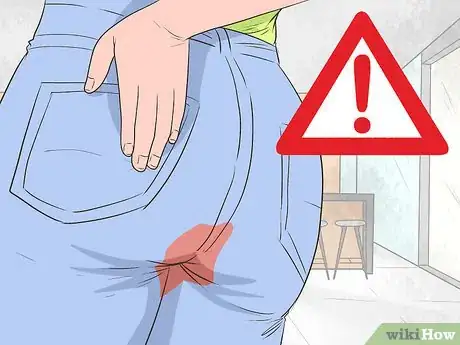 Image titled Stop Post Abortion Bleeding Step 1