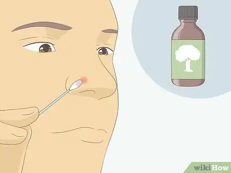 Image titled Get Rid of Acne Redness Fast Step 8