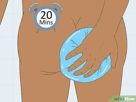 Image titled Reduce Hemorrhoid Pain Step 4