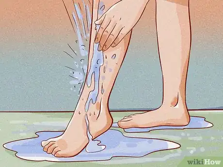 Image titled Use an Epilator Step 9