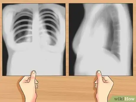 Image titled Read a Chest X Ray Step 8