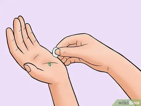 Image titled Remove a Pin or Tack from Your Skin Step 2