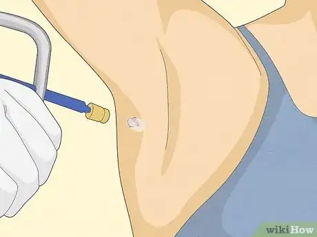 Image titled Get Rid of Skin Tags Step 15