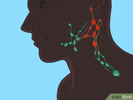 Image titled Recognize Cellulitis Symptoms Step 5